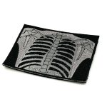 Патч Ренген легенів,рефлективний